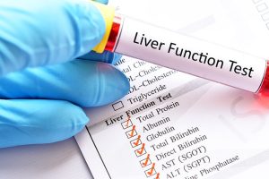 san antonio liver function testing physicians