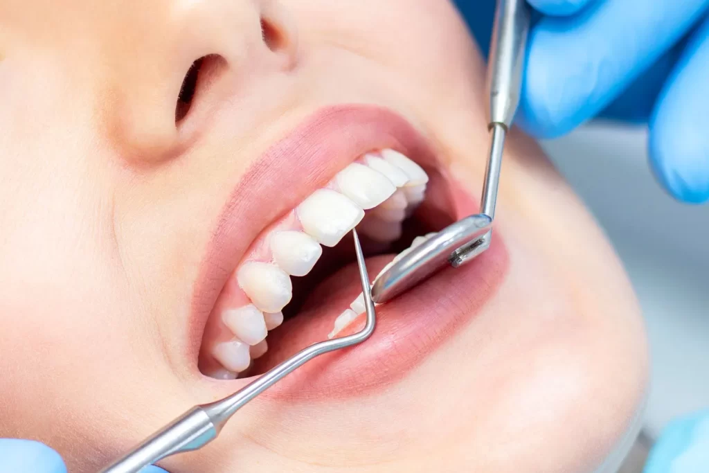 Best Dental Implant TX is the Perfect Dental Solution