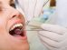 Best Dental Implant TX is the Perfect Dental Solution